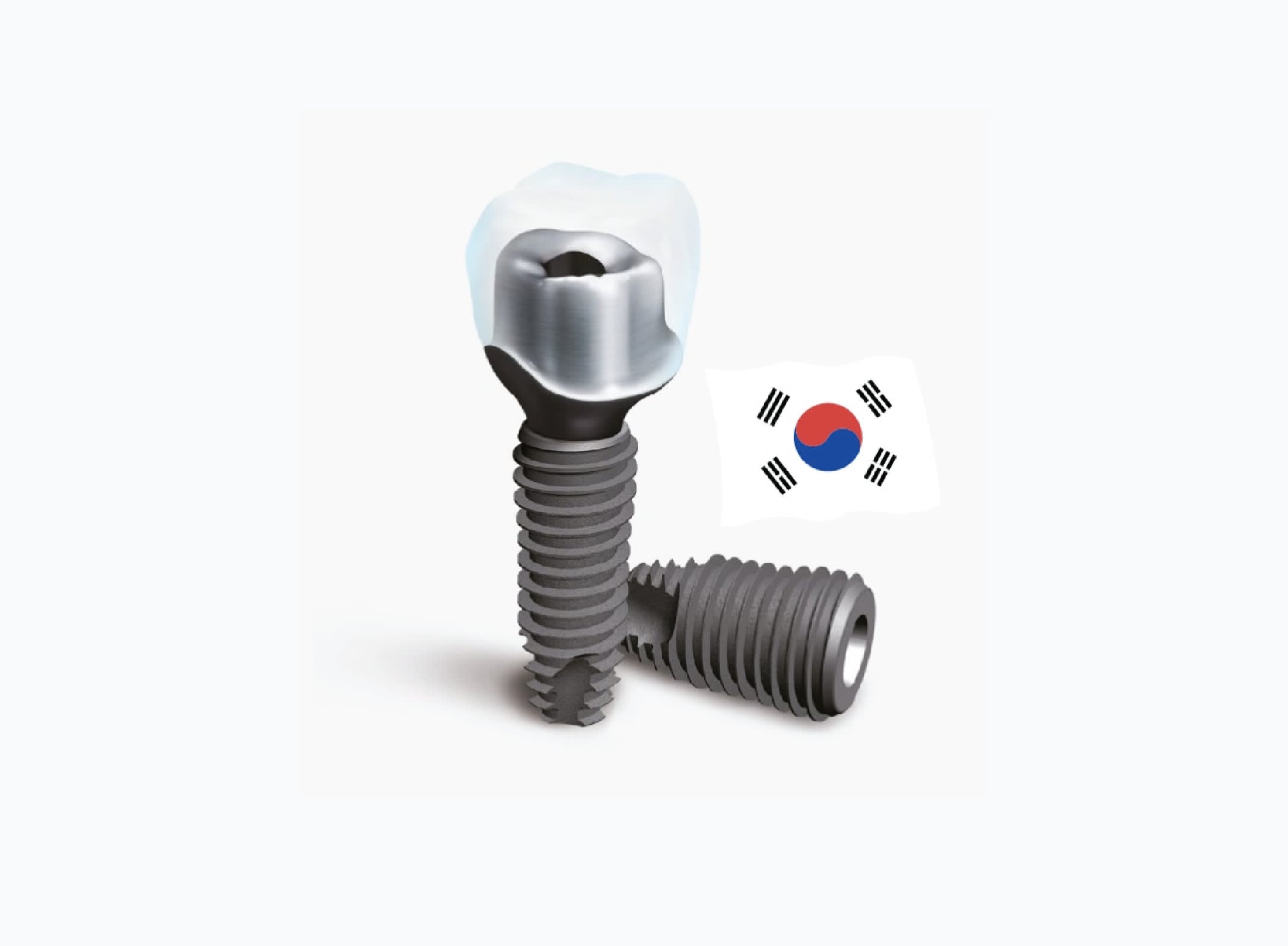 Cấy ghép Implant